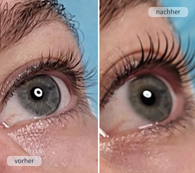 Wimpernlifting