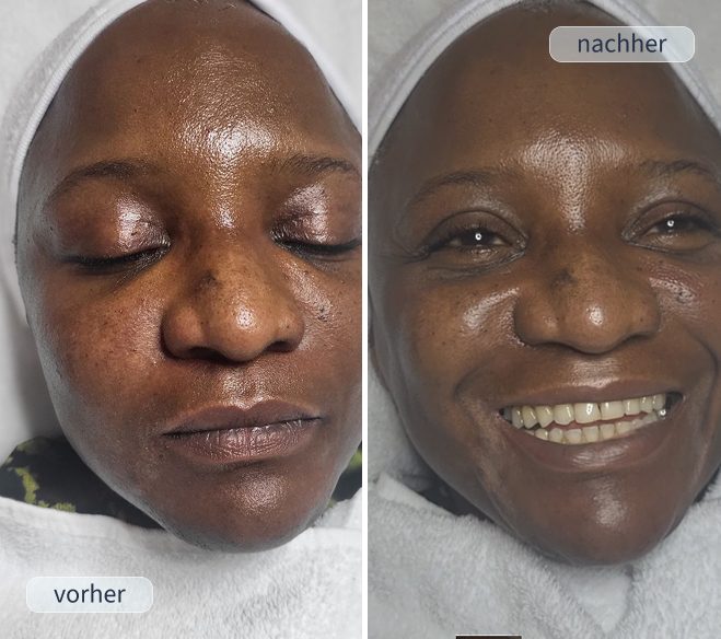 Anti-Aging Pflege