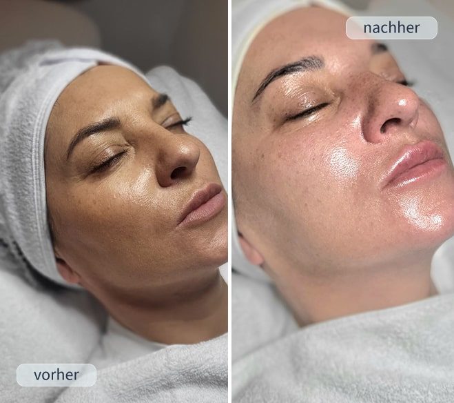 Anti-Aging Pflege